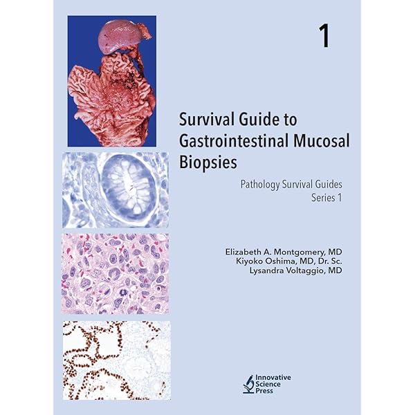 Survival Guide to Thoracic Pathology【新品】 Amazon.com: Survival Guide to Thoracic Pathology: 9798986743509